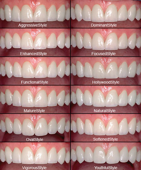 Twelve porcelain veneer smile styles chart — tooth shapes and designs patients can choose from at Dublin Ranch Dental, Dublin CA